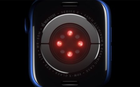 Apple Watch blood oxygen detection won’t be available on the Series 10 in the US