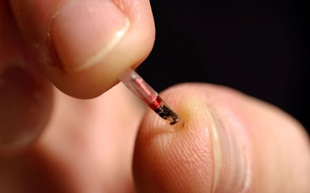 Woman Sets Guinness World Record For Most Chip Implantations