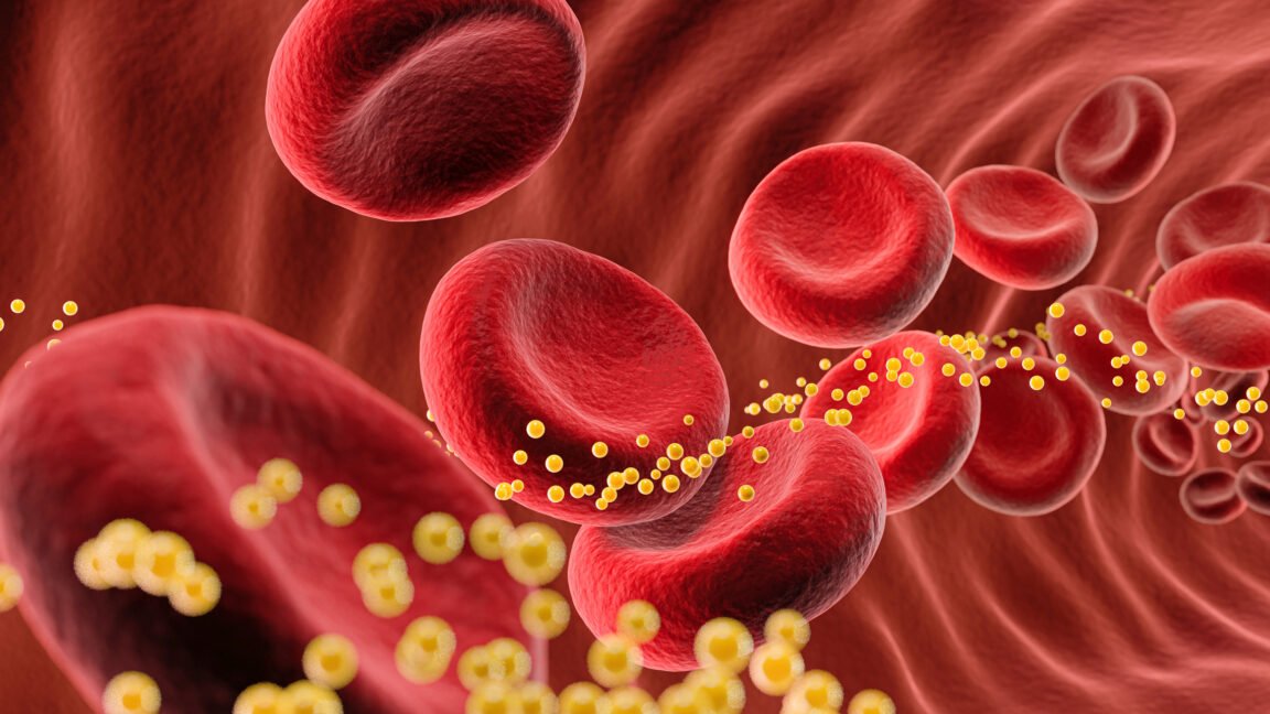 A medical professional prepares an intravenous infusion of experimental gene-editing therapy for cholesterol management.