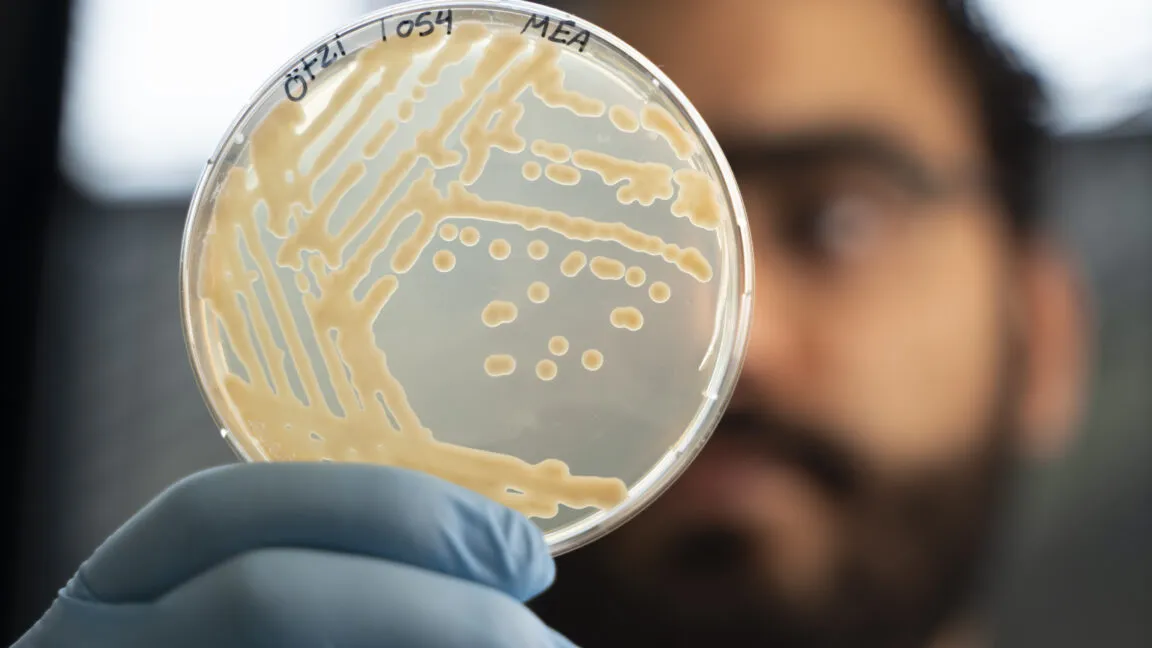Microscopic analysis of living yeast and soil bacteria preserved inside the five-thousand-year-old Otzi mummy.