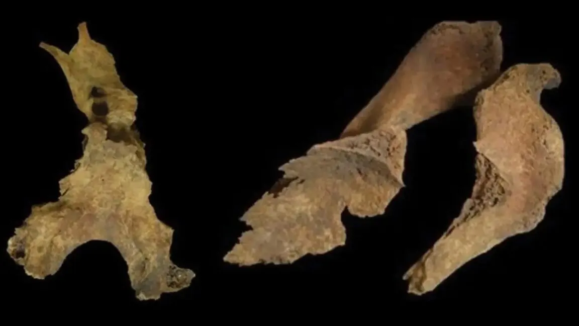 Archaeological skeletal remains from northwest Scotland showing evidence of Iron Age brain removal and bone manipulation.