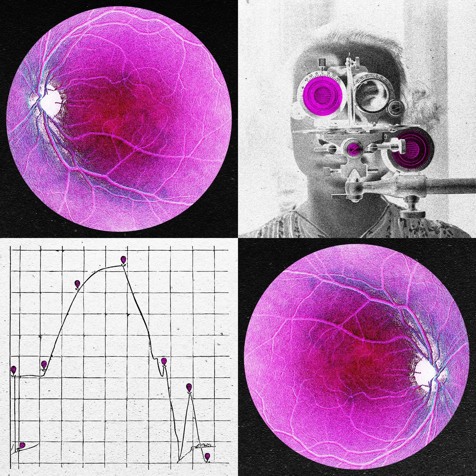 First Human Trial of Epigenetic Vision Therapy Begins Clinical Testing